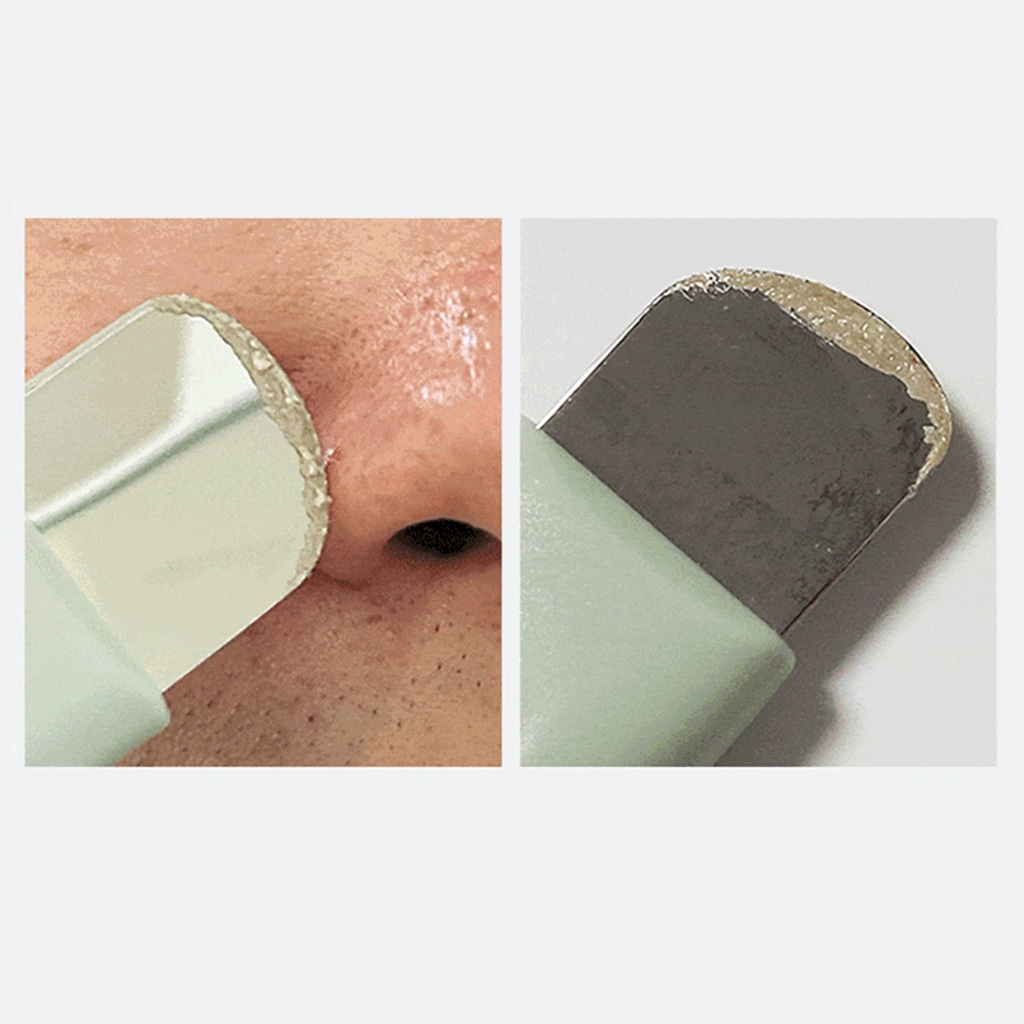 Ilso Deep Cleaner Master_thumbnail_3