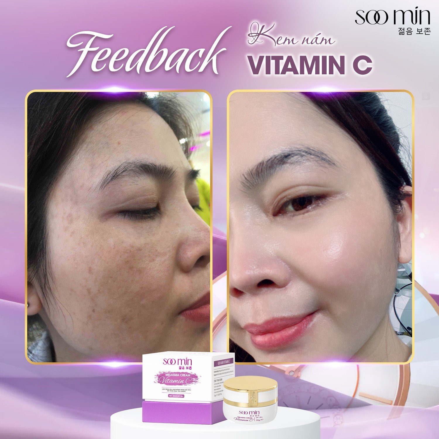 Kem Nám Vitamin C SooMin – Cứu Tinh Cho Làn Da Nám Sạm, Sáng Mịn Tự Nhiên_thumbnail_5