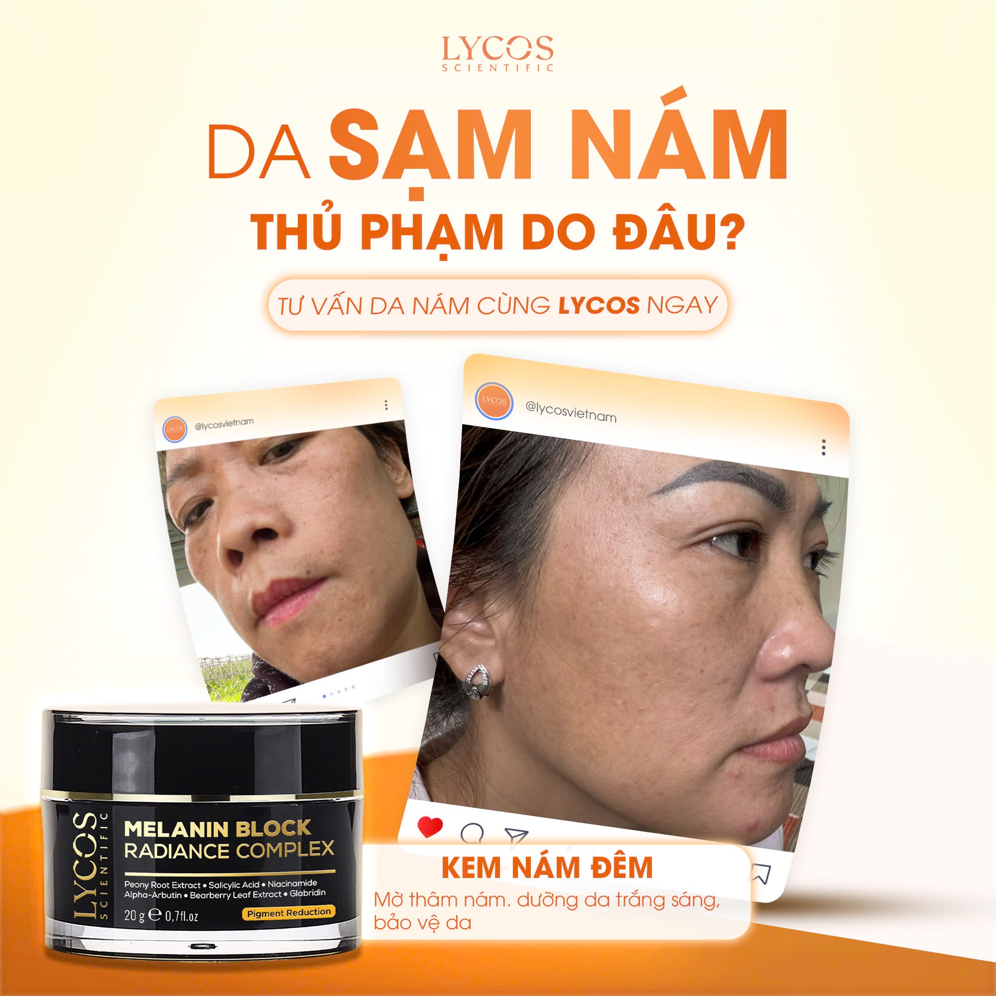 Kem Nám Đêm LYCOS Melanin Block Radiance Hỗ Trợ Mờ Nám, Tàn Nhang & Dưỡng Da Trắng Sáng 20g_thumbnail_9