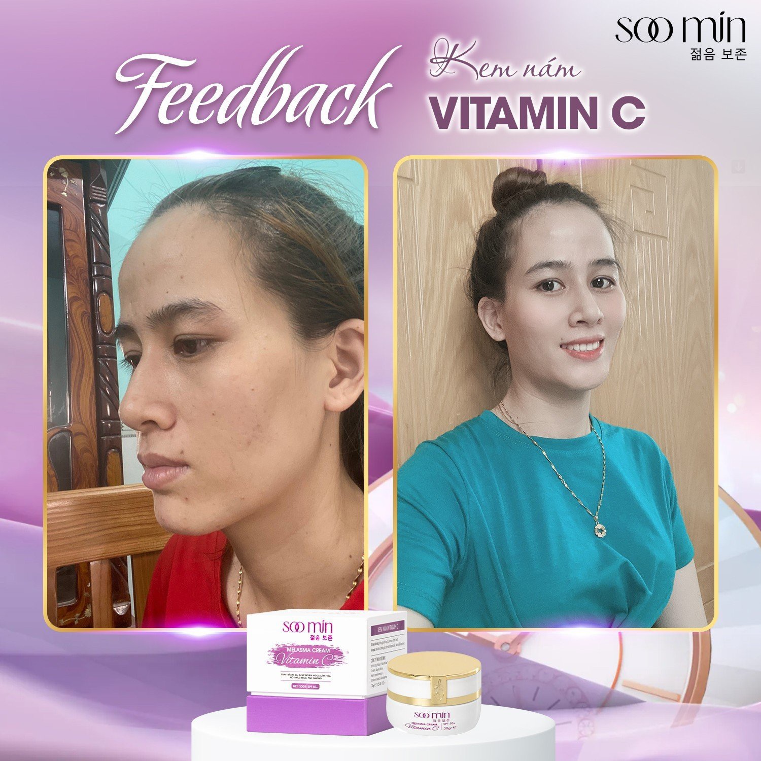 Kem Nám Vitamin C SooMin – Cứu Tinh Cho Làn Da Nám Sạm, Sáng Mịn Tự Nhiên_thumbnail_6