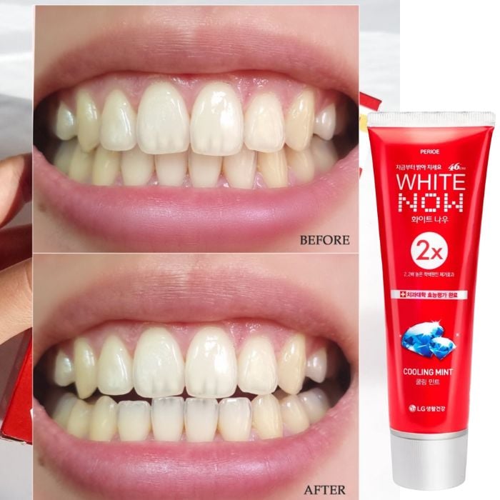 Set Kem đánh răng Perioe LG (5 cây)_thumbnail_13