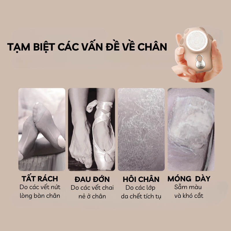 Máy Chà Gót Chân NMIMART Tẩy Tế Bào Chết Tự Động, 3 Đầu Mài Đa Dụng MCG01_thumbnail_6