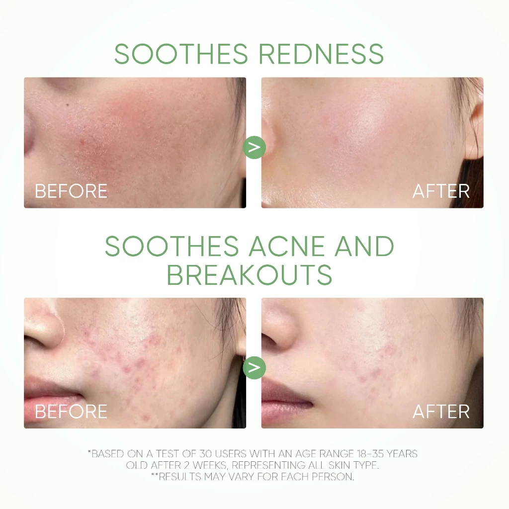 SKINTIFIC Mugwort Clay Mask Stick 40g_thumbnail_6