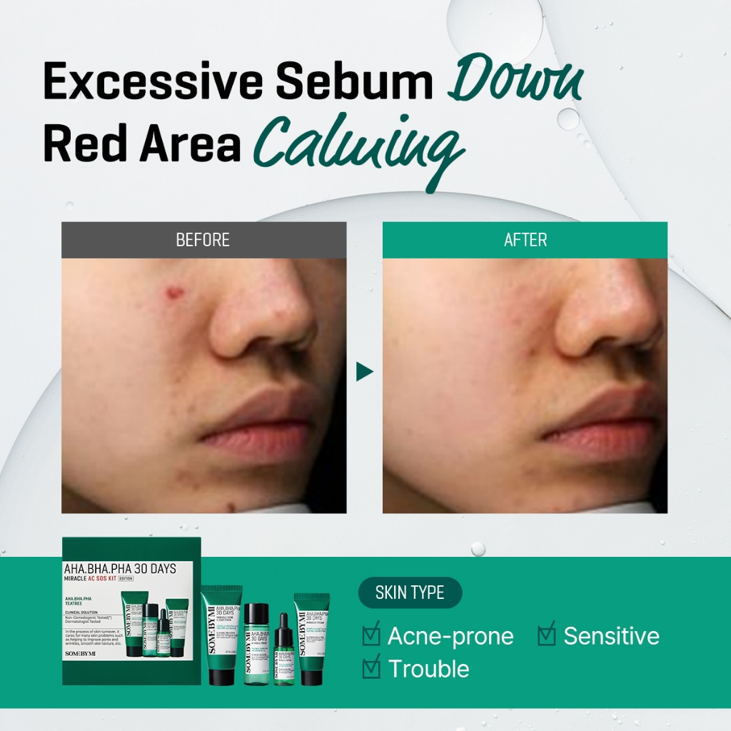 SOME BY MI AHA BHA PHA 30-Days SOS Miracle Kit_thumbnail_3