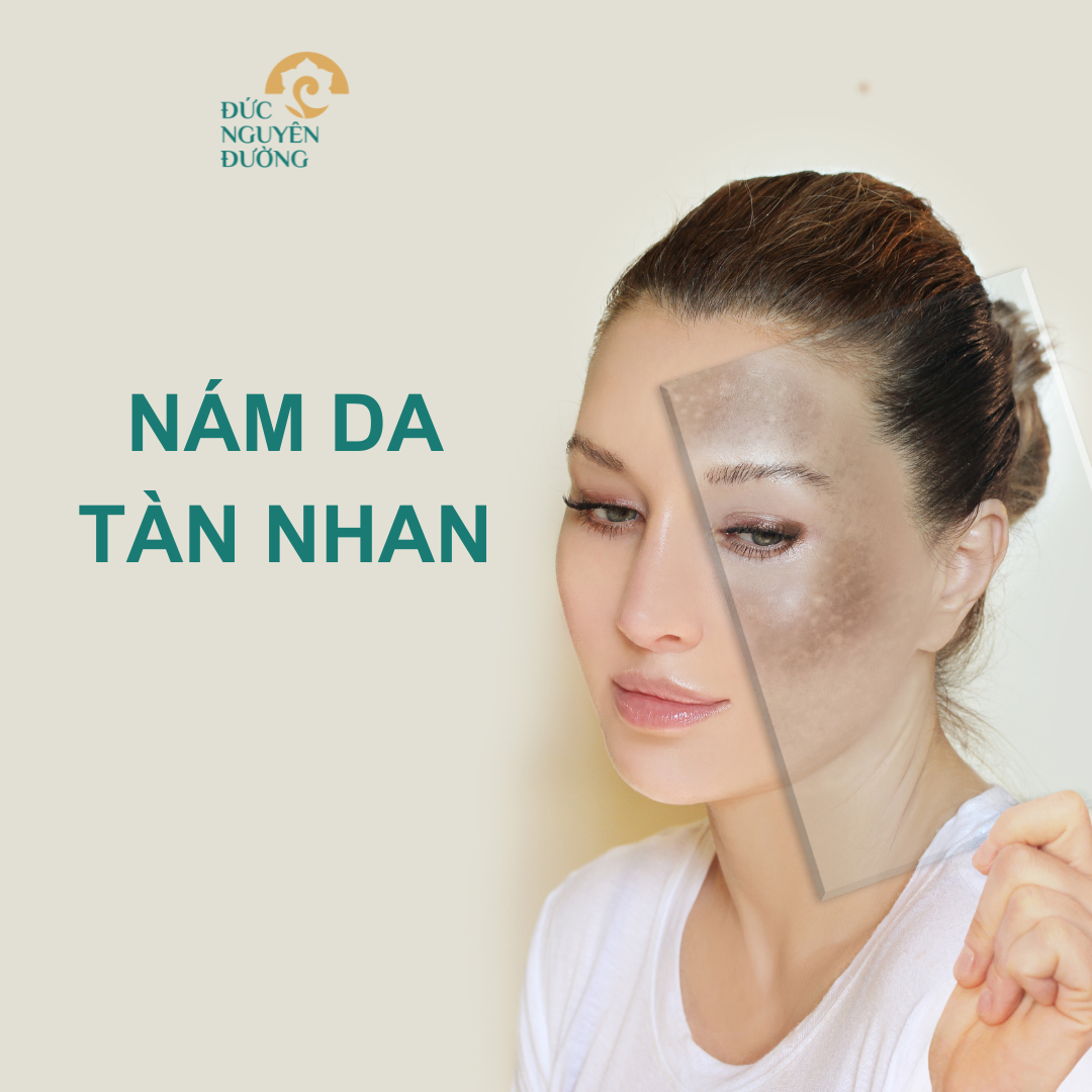 Nám da, tàn nhang