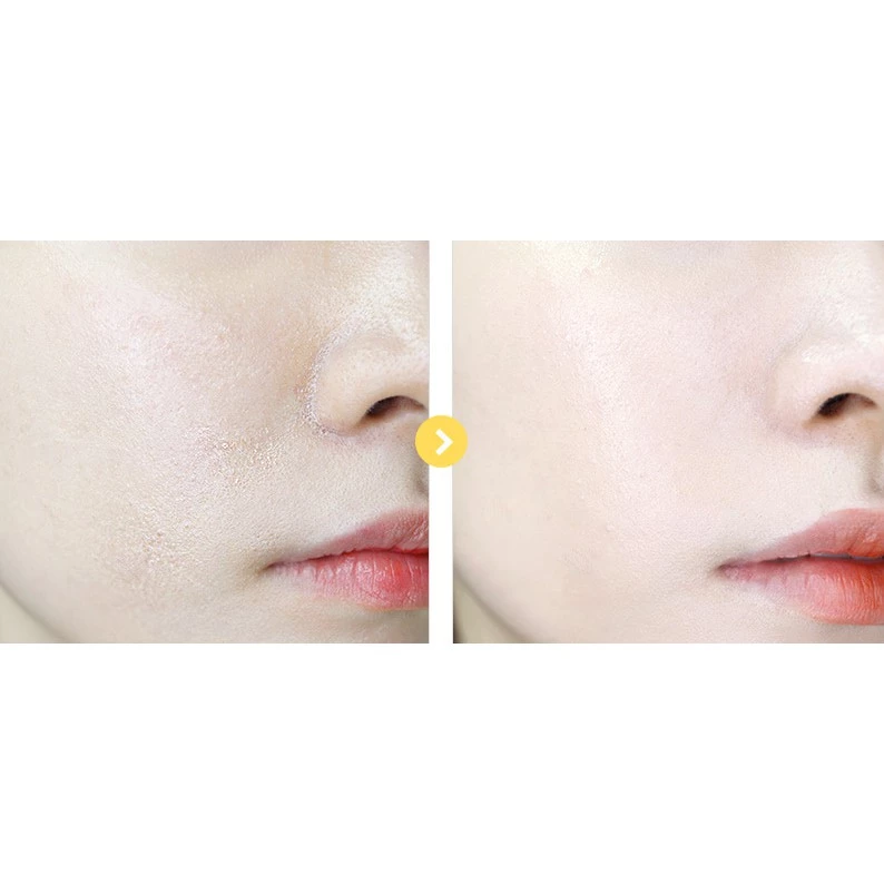 Graymelin Pineapple Mild Peeling Gel 100ml_thumbnail_2