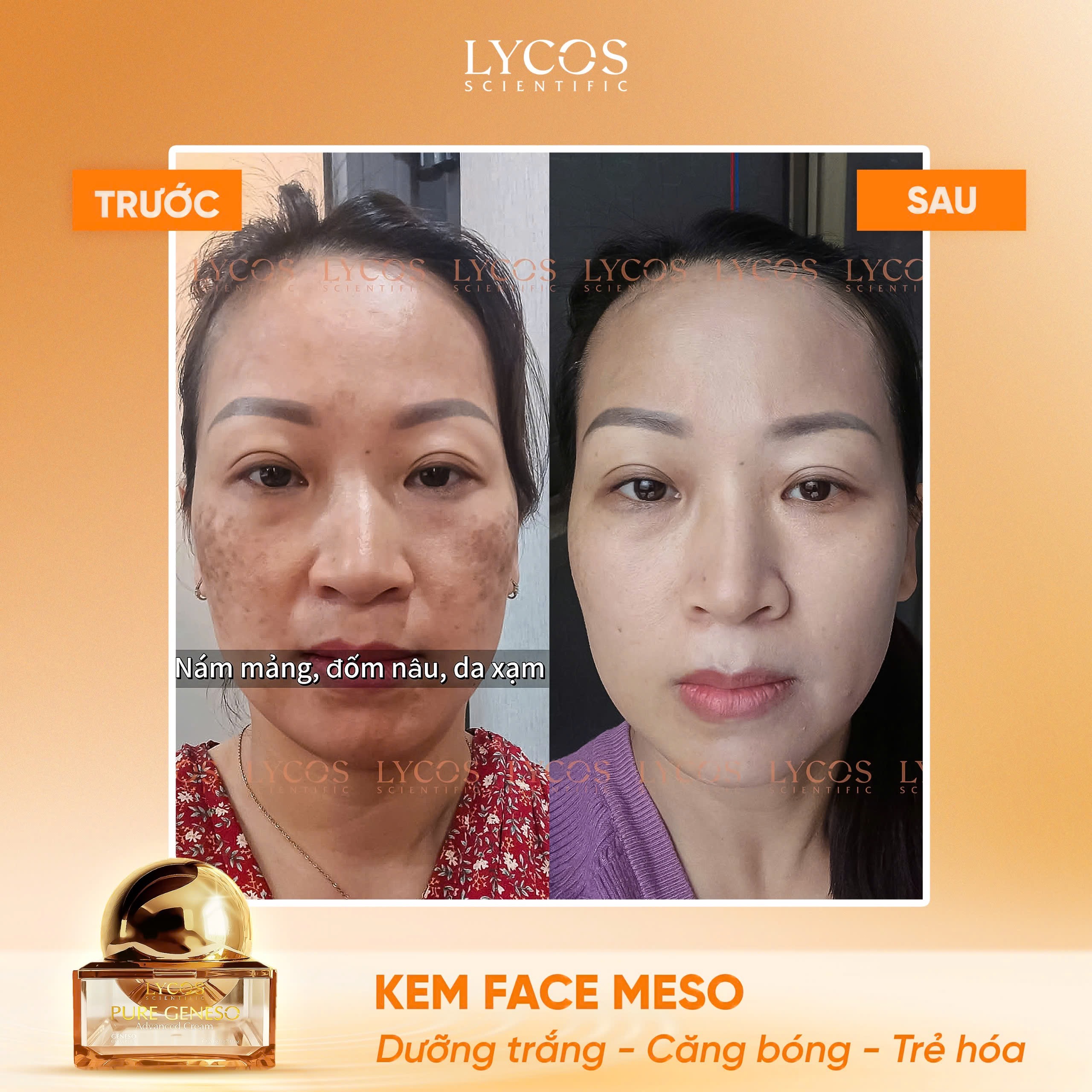 [MUA 1 ĐƯỢC 2] Kem Face Meso LYCOS Dưỡng Trắng, Căng Bóng & Dưỡng Da Mềm Mịn 20g – Tặng 1 Serum Cốt Hoa_thumbnail_9