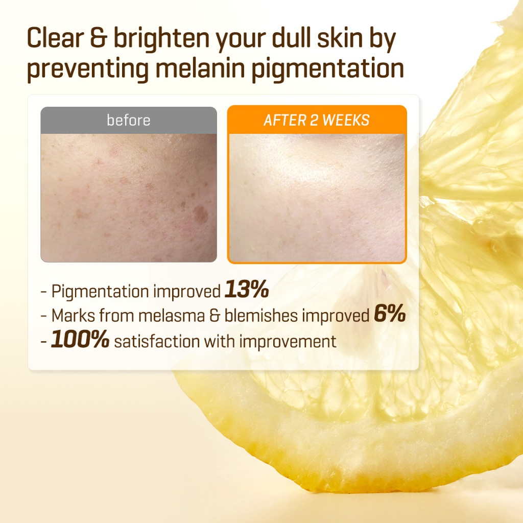 Some By Mi Yuja Niacin Anti Blemish Cream 60 g_thumbnail_7