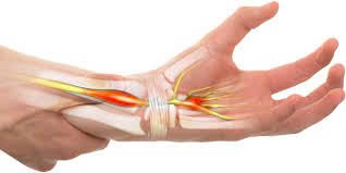 Hội chứng ống cổ tay – Bệnh lý thường gặp ở dân văn phòng_thumbnail_2