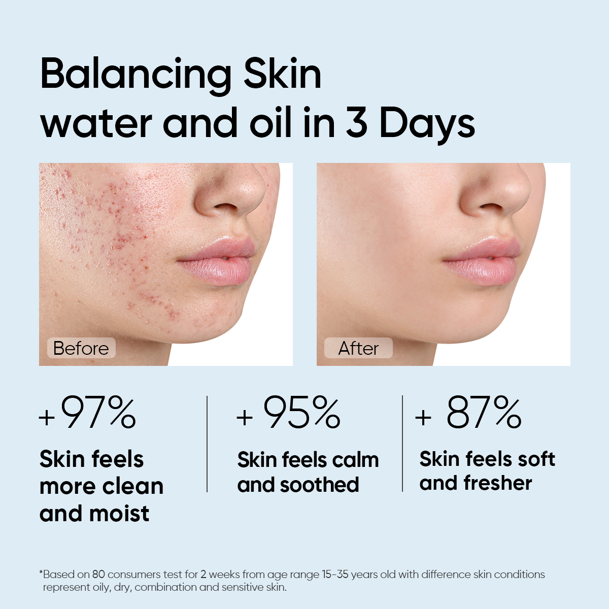 Skintific Amino Acid Ultra Gentle Cleansing Mousse_thumbnail_6