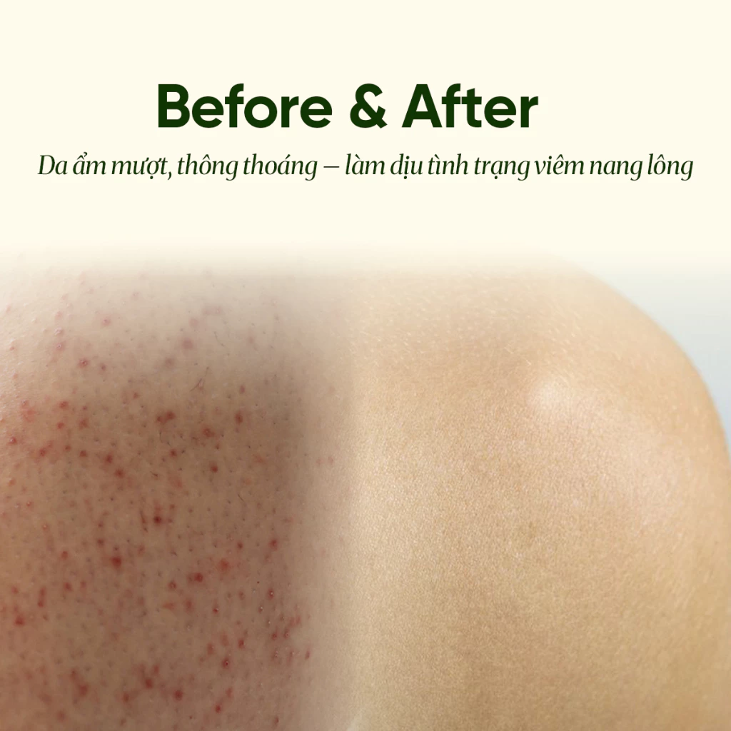 Sữa Tắm Pura D'or Awakening Body Wash Giúp Làm Sạch & Dưỡng Ẩm 473ml_thumbnail_6