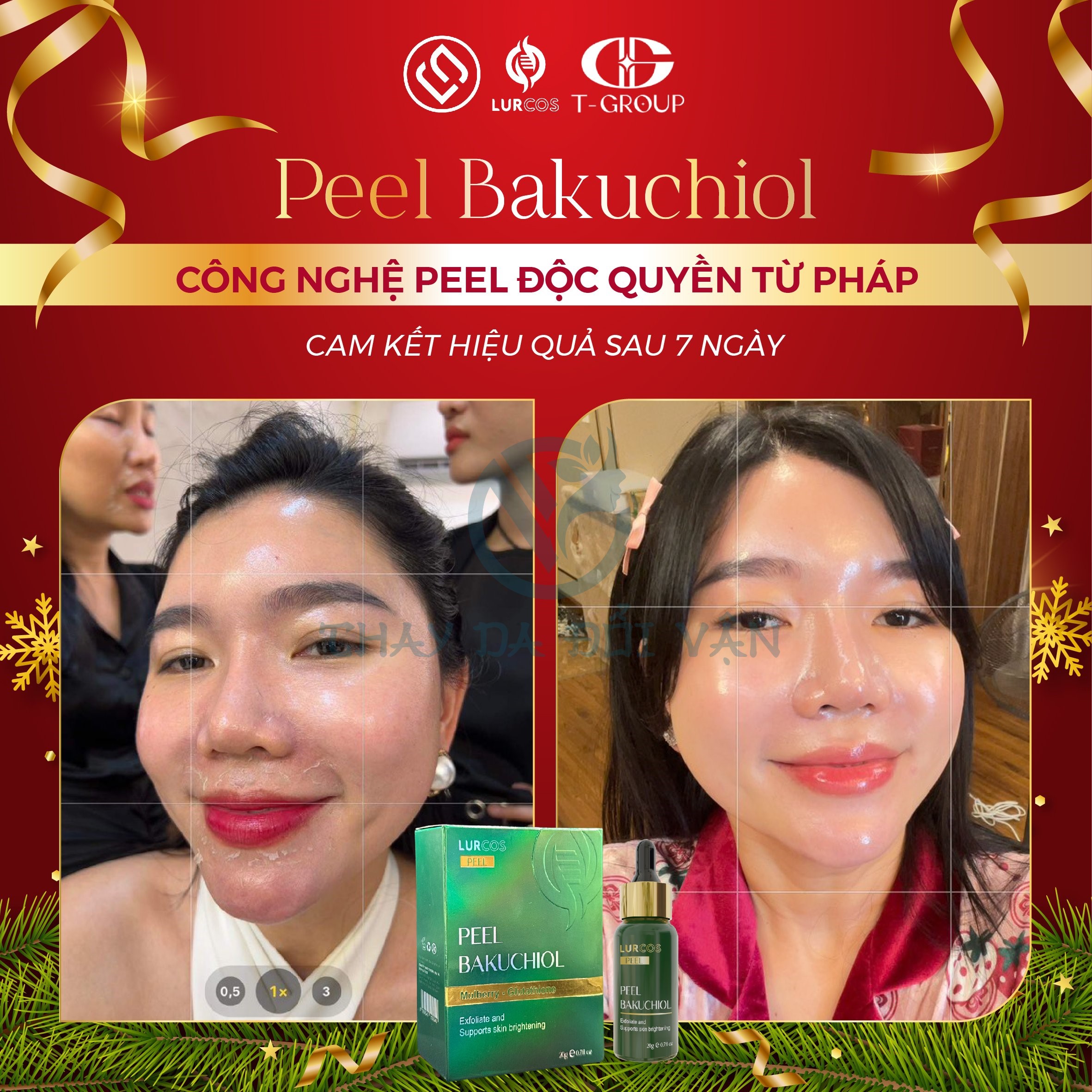 Tái Tạo Phục Hồi Da Cấp Độ Tế Bào Lurcinn Peel Bakuchiol_thumbnail_3