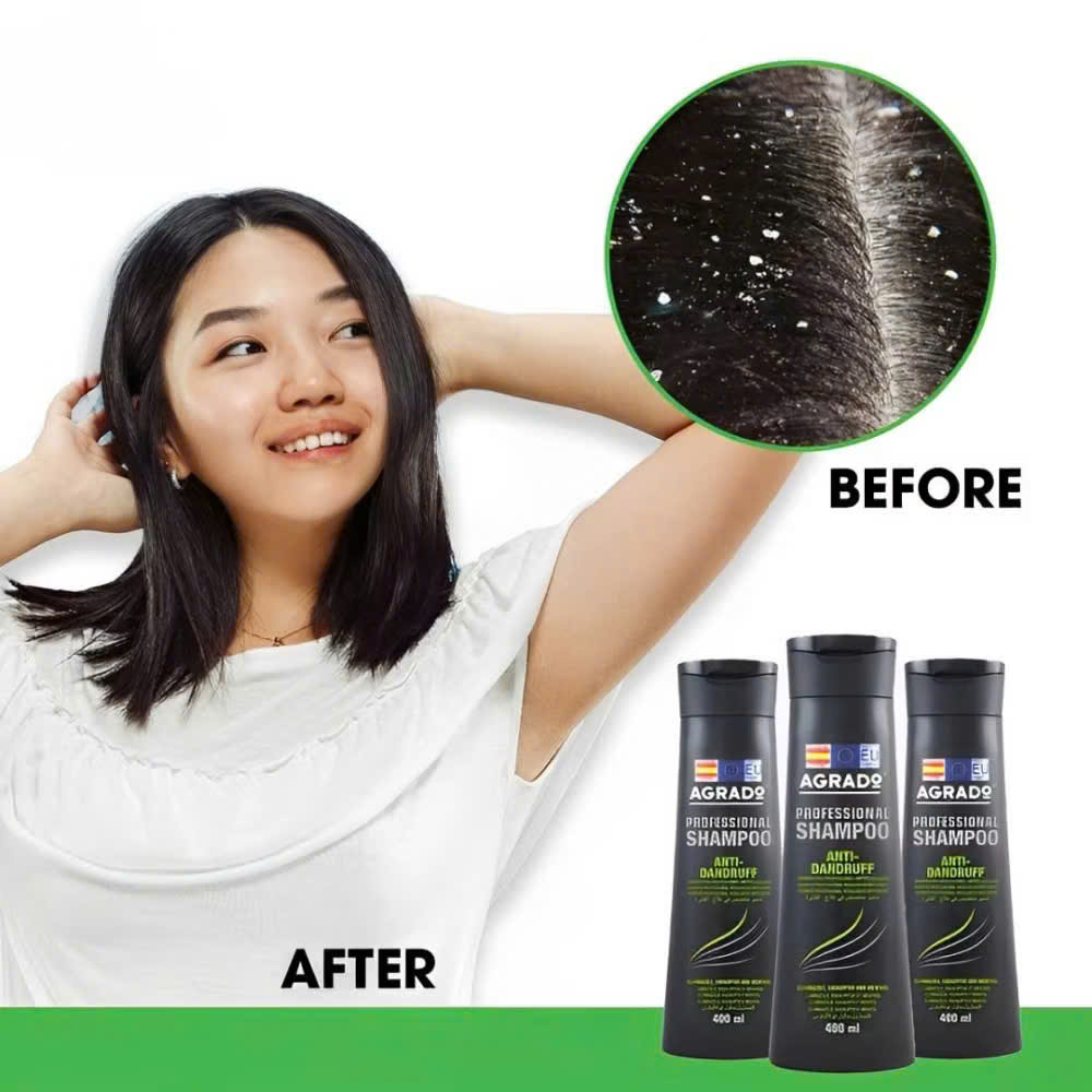 D11 DẦU GỘI ĐẦU NGĂN NGỪA GÀU_thumbnail_9