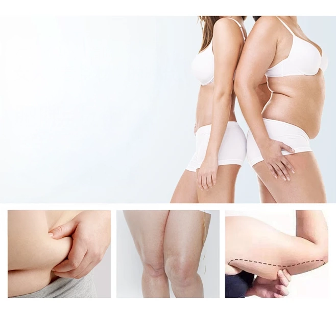 truoc-sau-giam-can-5-Copy