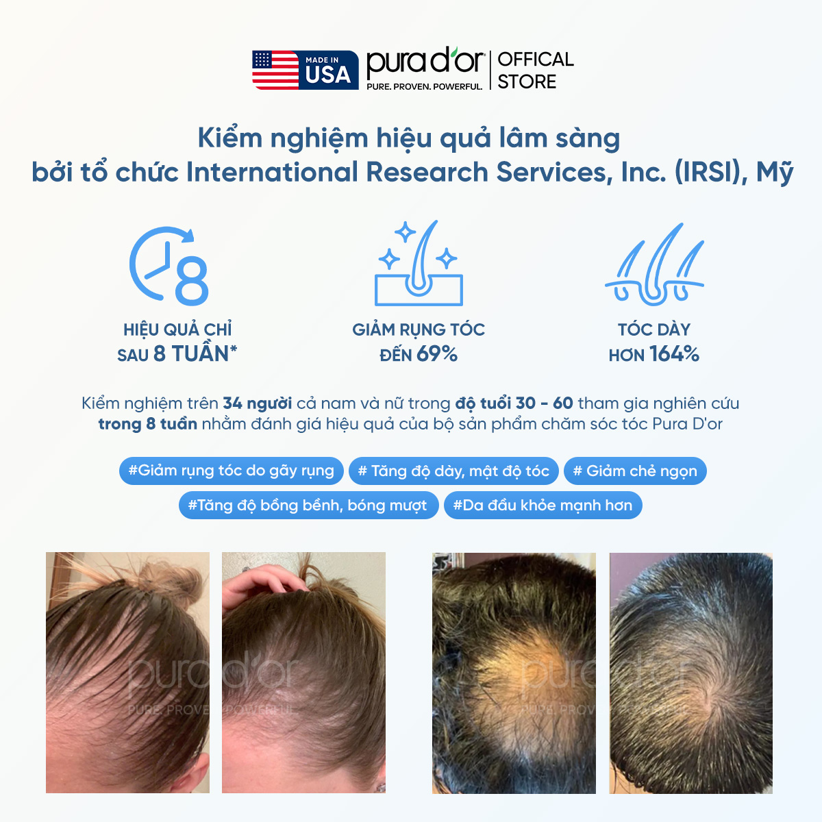Tinh chất hữu cơ Therapy Energizing Scalp Giúp trẻ hóa da đầu - Giảm rụng tóc, mọc tóc chắc khỏe 120ml_thumbnail_2