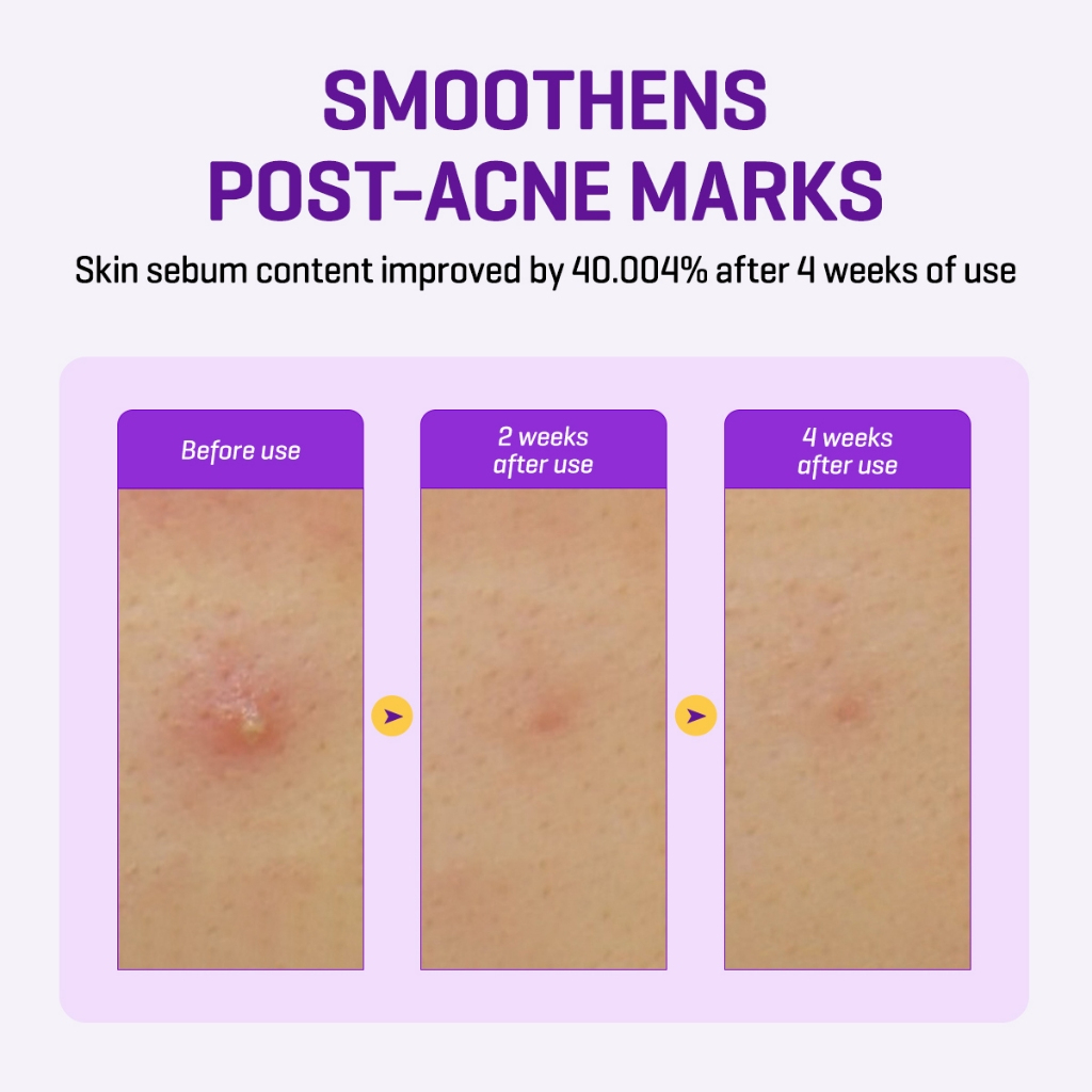 Some By Mi RETINOL INTENSE Reactivating Serum 30ml_thumbnail_1