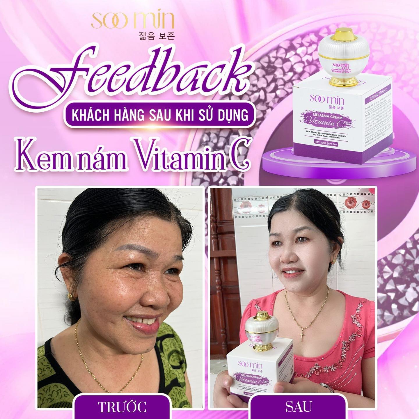 Kem Nám Vitamin C SooMin – Cứu Tinh Cho Làn Da Nám Sạm, Sáng Mịn Tự Nhiên_thumbnail_9