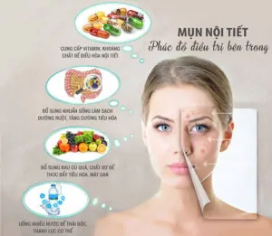 Chế Độ Dinh Dưỡng Đặc Biệt Giúp Giảm Mụn Nội Tiết Tố