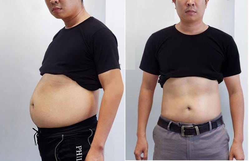 truoc-sau-giam-can-2