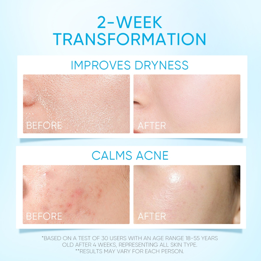 SKINTIFIC 5X Ceramide Facial Moisturizer [Damaged Box EXP2027]_thumbnail_4