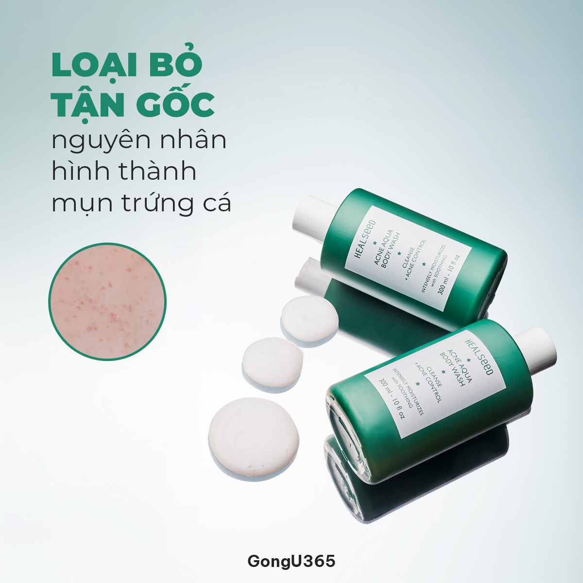 HEALSEED ACNE AQUA BODY WASH - Sữa Tắm Giảm Mụn Cơ Thể & Làm Sạch Sâu – Salicylic Acid & 7HA – 300ml - [HS008]_thumbnail_5