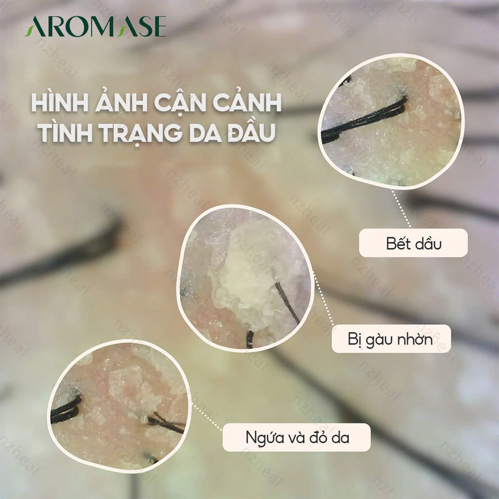 Dầu gội AROMASE_thumbnail_9