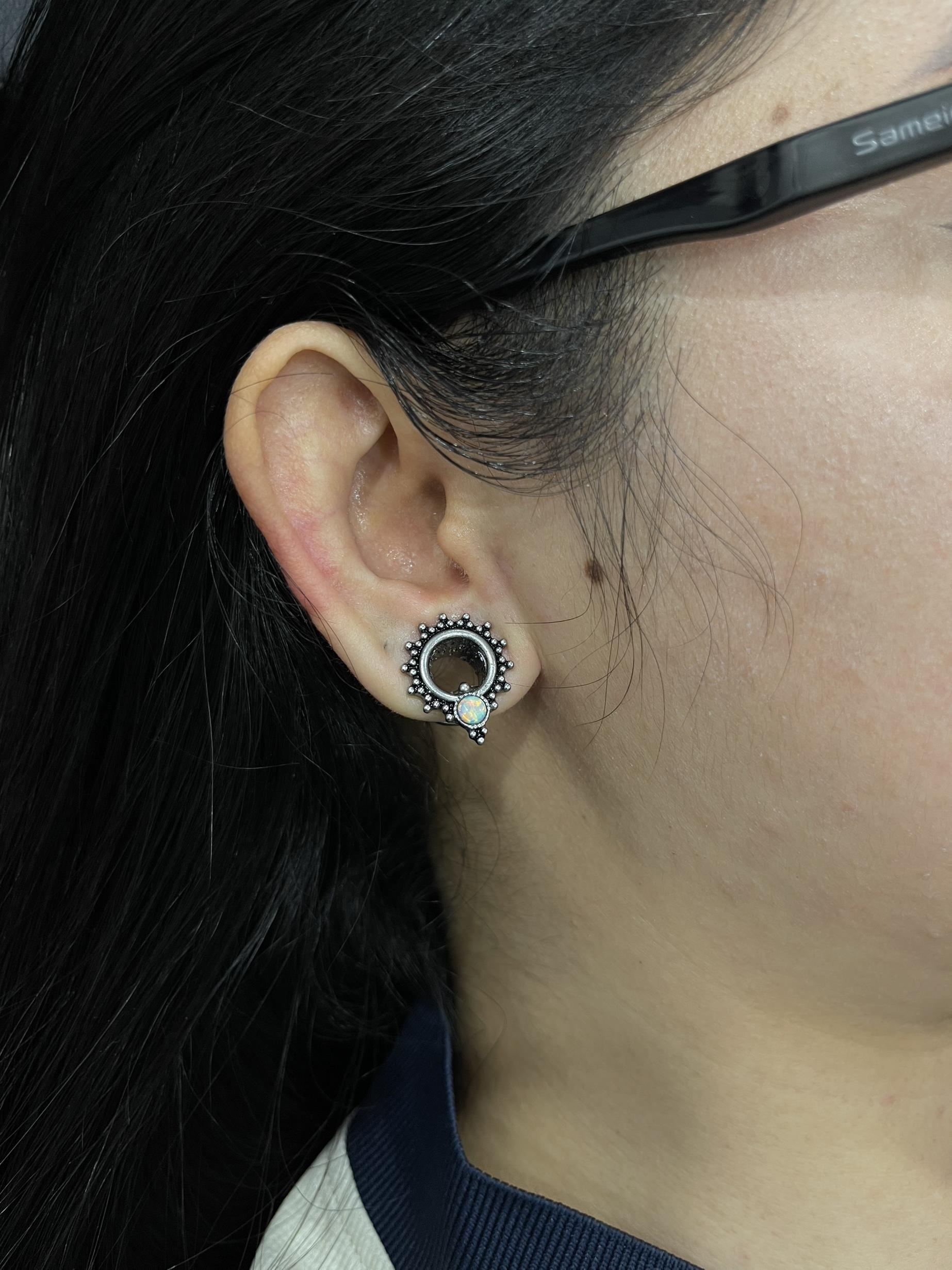 DVdịch vụ nong tai size 10 có tiêm tê